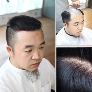 卡瑞丝男士补发透气精品手织单网个性定制头顶补发片无痕隐形织发