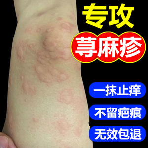 李氏百草膏寻荨麻疹过敏止痒断根专用药药膏皮肤瘙痒根源过敏喷雾