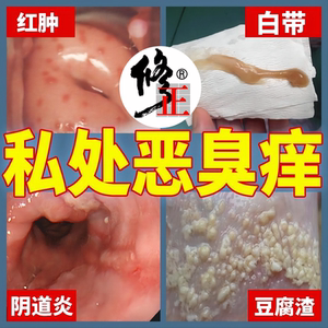 女生洗下体止痒