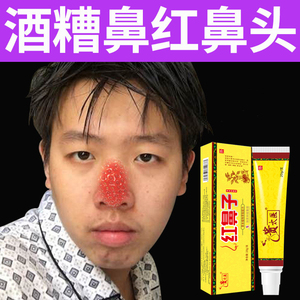 酒糟鼻修复红鼻子专用药软膏鼻螨清红肿收缩毛孔去黑头粉刺草莓鼻