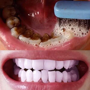 美白牙齿神器速效去黄牙烟牙茶渍牙垢洁牙慕斯泡沫牙膏除口臭正品