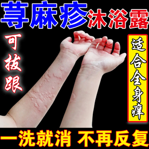 寻荨麻疹专用沐浴露过敏止痒断跟急性慢性风团皮肤瘙痒中药浴泡澡