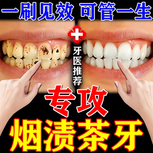 强力去烟渍牙膏去牙齿黄神器茶牙克星牙垢结石亮白洗牙渍一擦即除