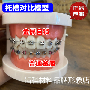 牙科口腔2种托槽对比模型 正畸 金属自锁托槽托槽示范模型包邮