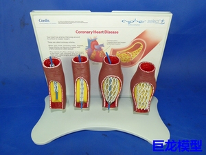 人体血管堵塞支架模型 人体心脑血管堵塞教学演示模型 人体支架