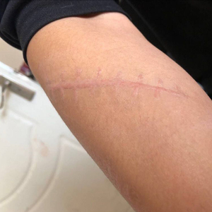 假伤疤增生疤痕影视万圣节化妆品假血浆 刀疤水cos仿真伤口贴包邮