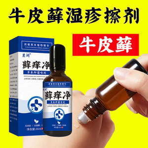 牛皮癣脚气手足癣葡萄球菌念珠菌湿疹脱屑瘙痒冰山皮肤喷剂克癣净