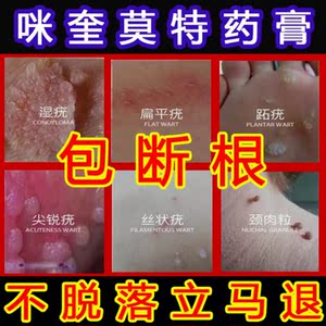 扁平肉粒腋下克疣液石疣趾疣去除膏寻常疣瘊子立净皮赘17人付款159