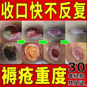 玉红生肌膏同仁堂伤口损伤修休复万红京膏褥搓疮愈和合老烂腿压疮