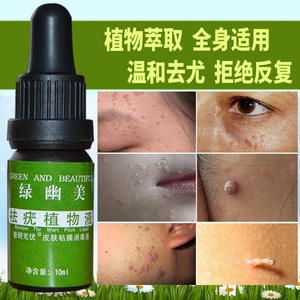 去除面部肉刺瘊子丝状扁平疣必治脖子颈部肉粒去疣灵趾尤净膏特效