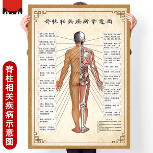 人体脊柱脊椎骨颈椎图脊柱相关疾病示意图经络穴位脊椎海报挂图