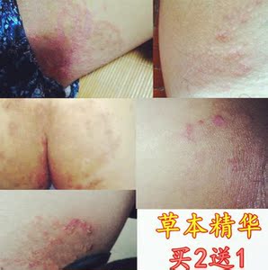 791人付款淘宝男士蛋蛋剃毛器电动剃毛器私处女士脱毛仪除腋毛腿毛