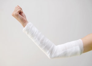 正品可耐特医用高分子绷带夹板骨折固定可替代石膏聚氨酯玻璃纤维