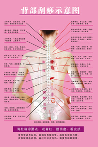 淘宝中医经络美容养生脊椎挂图展板宣传画海报图片定制背部刮痧示意图