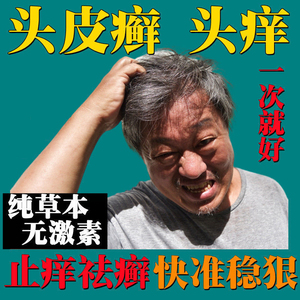 治头癣头部牛皮藓癣头皮屑真菌感染剂洗发水毛炎囊银屑病外用药膏