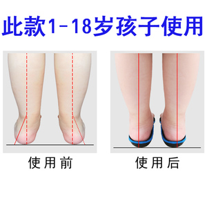 儿童扁平足矫正鞋垫宝宝内八字纠正垫X腿足外翻矫正足弓支撑鞋垫