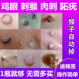 去除猴子刺猴肉手部