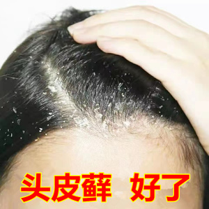 李氏百草膏头皮藓药真菌感染头皮癣专用药膏头头皮屑银屑癣头部治