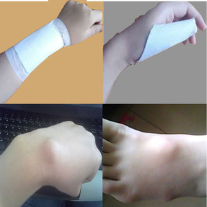 手腕大拇指腱鞘炎贴膏药腱鞘囊肿专用膏舒筋痛舒贴鼓包治疗网球肘