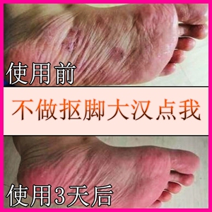 神奇的草珊瑚净癣去足癣脚藓脚廯脚鲜一次净含量去脚臭脚汗