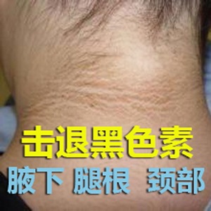 维生素e软膏液皮肤黑脖子黑色素去除颈部黑棘皮军训晒后修复美白
