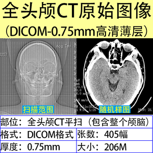 A025-医学影像全头颅脑骨CT高清薄断层扫描检查原始DICOM数据图像