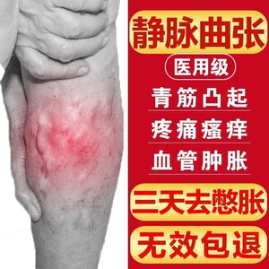 好士德派菲特治疗型静脉曲张袜弹力医用术后压力二级中压短筒开口