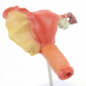 子宫卵巢疾病生殖系统模型女性内外生殖科妇产科医学教学用健康妇科