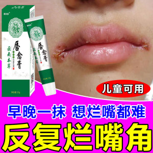 烂嘴角儿童