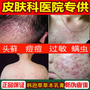 背上长痘痘后背螨虫叮咬过敏止痒断根专用药人用皮肤病去头藓药膏