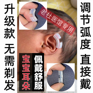 婴儿耳朵矫正器新生的儿耳廓矫形器宝宝招风耳隐耳垂耳畸形耳纠正