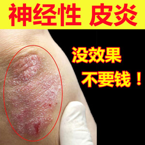 李氏百草治疗神经性皮炎去根除外用膏日光性止痒的药膏皮肤病专用