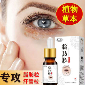 眼霜去脂肪粒汗管瘤神器去除油脂粒专用膏眼部消淡化黑眼圈细纹