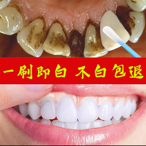 日本洁牙粉去黄洗白牙结石速效黄牙口臭污垢除牙石器牙齿美白神器
