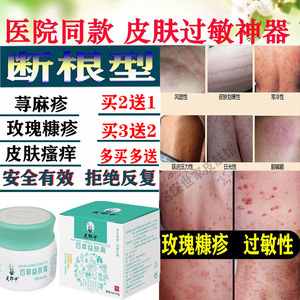 治疗玫瑰糠疹专用药膏胆碱能性荨寻麻疹过敏止痒断根皮肤瘙痒外用