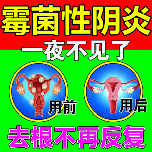 治霉菌性阴炎豆腐渣反反复复益生菌阴道抑菌清洁凝胶白带量多发黄