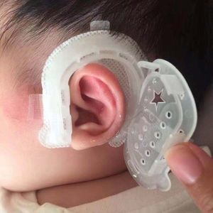 新生儿耳廓矫正器纠正婴儿耳朵变形宝宝小儿耳畸形招风耳隐耳底座