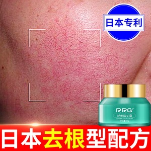 日本去红血丝修复角质层增厚面霜改善敏感肌脸部泛红发烫皮肤屏障
