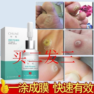 80tb95484182淘宝疣瘊肉粒一抹无忧疣必净疣瘊软膏祛疣瘊子疣必治