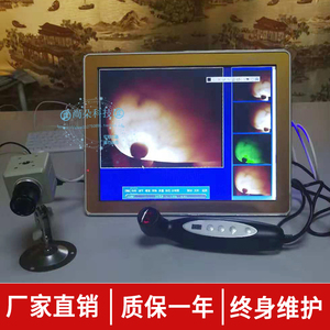 红外线乳腺测试仪一体机胸部乳透仪乳房透照胸透仪检查美容院检测