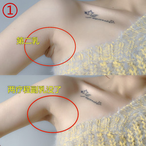 改善副乳内衣收副乳