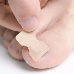 嵌甲矫正贴片脚趾甲往肉里长指甲内嵌矫正器正甲贴家用护理贴神器