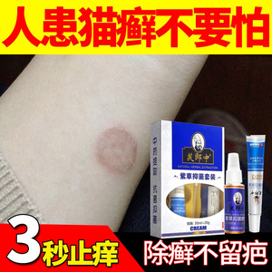 人用猫藓药猫藓外用药人用猫癣专用药人得猫癣皮肤病真菌止痒药膏