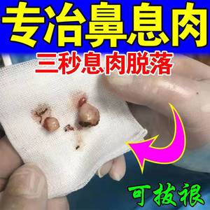 鼻息肉鼻甲肥大专用药治疗鼻塞鼻炎鼻窦炎喷剂消炎修复一喷灵神器
