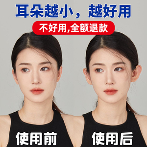 精灵耳贴招风耳贴面耳固定隐形显脸小硅胶拍照直播支撑神器