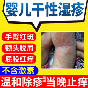 宝宝婴儿童身体乳干性湿疹红屁股护臀药膏泡澡包尿布疹长痘痘cs