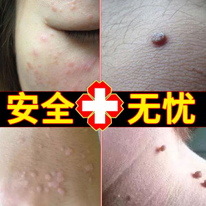 【克优软膏】克优软膏品牌,价格 - 阿里巴巴