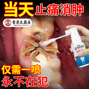 牙疼牙痛止疼药水速效喷剂宁杀牙龈肿蛀牙虫牙神经智齿牙克星专用
