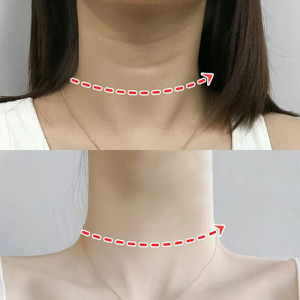 去脖子颈纹女去颈纹