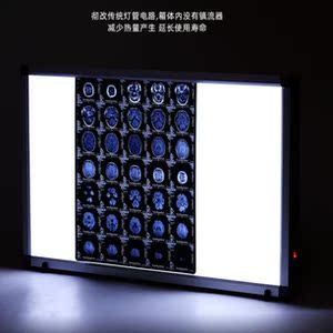 观片灯看片灯箱医用观片器阅片灯超薄x光读片灯厂家直销观片灯箱